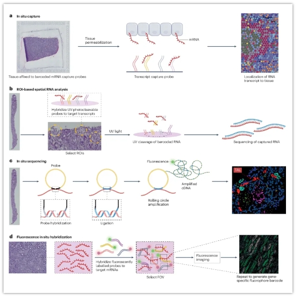健康和疾病中的空间转录组学-2.png