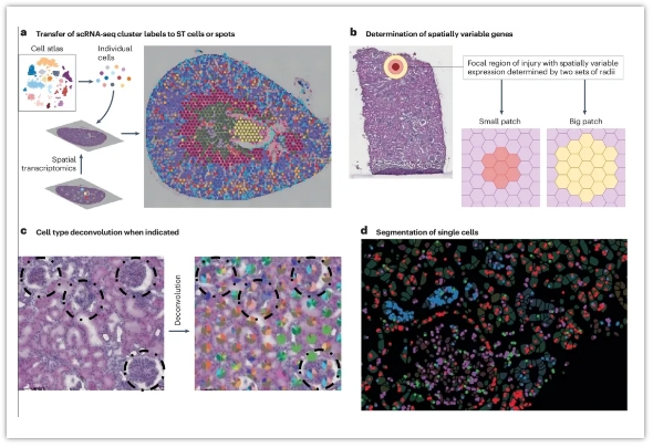 健康和疾病中的空间转录组学-4.png