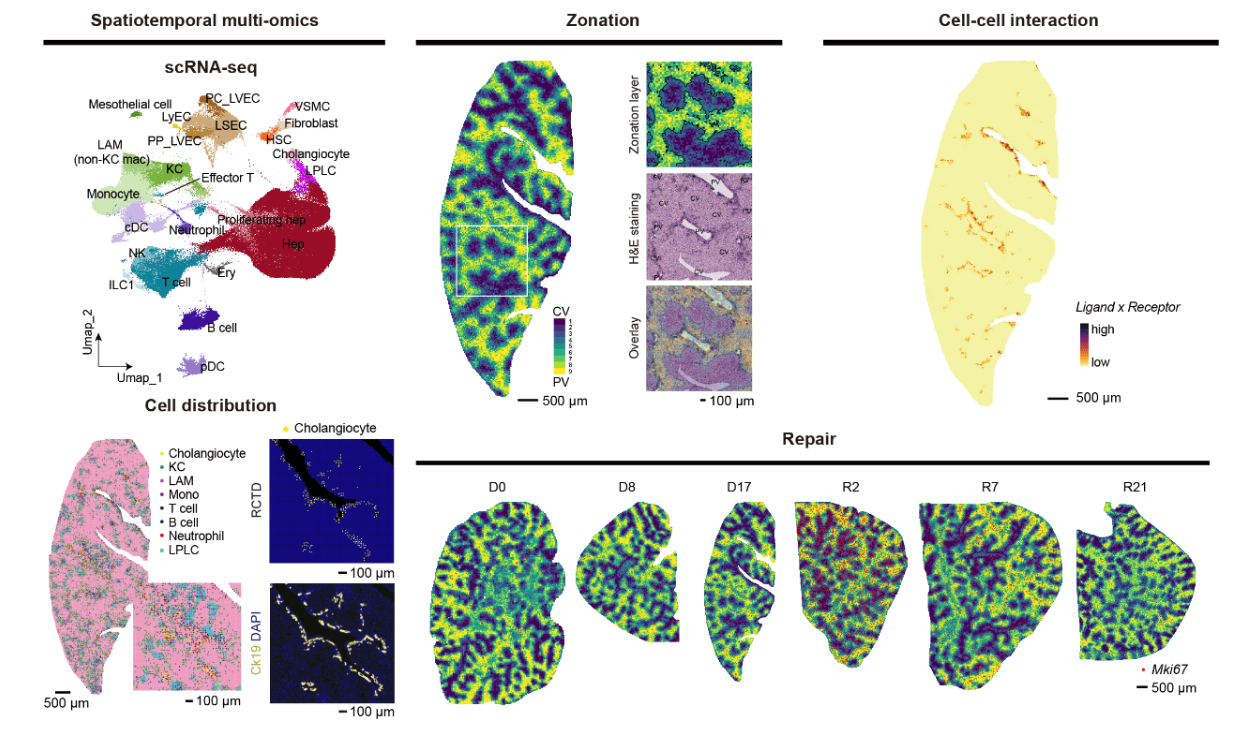 Cholestatic Injury and Repair Spatio-Temporal Atlas