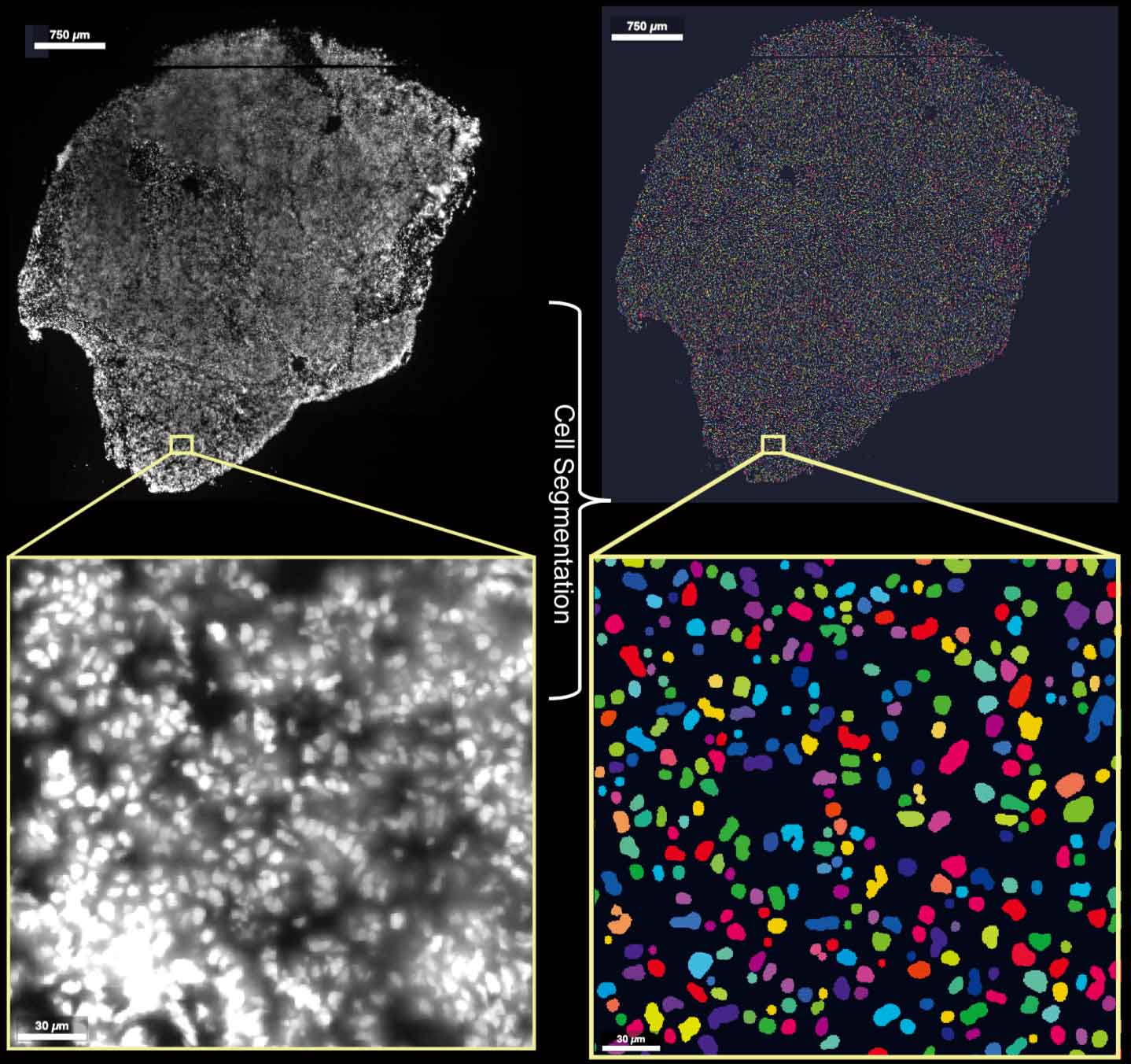 Stereo-seq